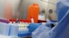 Peneliti Identifikasi 69 Obat yang Bisa Bantu Memerangi Virus Corona