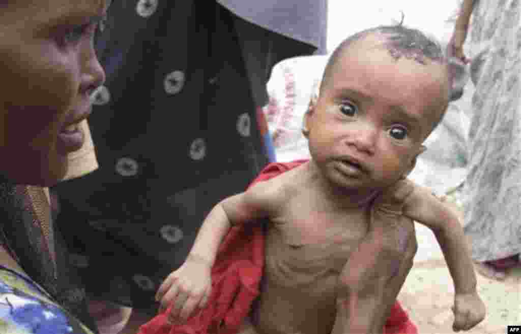 A Somali woman tenderly holds her daughter in Mogadishu, Somalia, Friday, July 22, 2011. Drought and lack of food is forcing people to migrate to seek aid and medical help, with some thousands of people arriving in Mogadishu over the past two weeks. The 