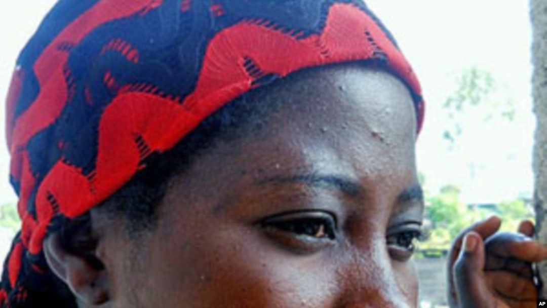 Mortalidade infantil cai na África Subsaariana