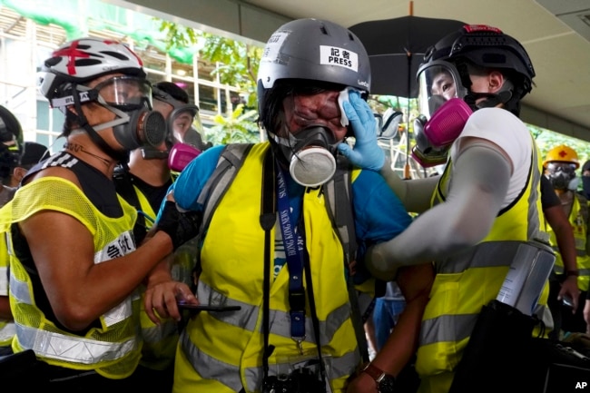 Veby Mega Indah, jurnalis asal Indonesia, dibantu oleh beberapa orang saat cedera, di Hong Kong, 29 September 2019. (Foto: AP)