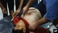 24일 알레포서 벌어진 정부군의 공격으로 부상을 입은 소년.