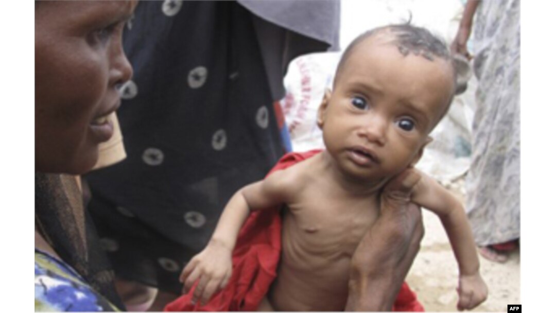 Somalida misli ko'rilmagan qahatchilik, kasalliklar tarqalmoqda