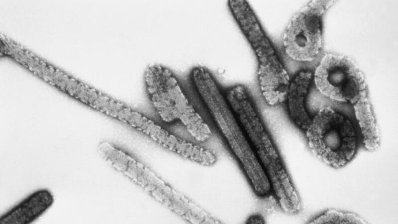 Virus de Marburg : deux nouveaux décès en Guinée équatoriale