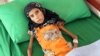 Kisah Fatima: Gadis Kelaparan Korban Perang Yaman, Bagaimana Peran Jazirah Arab?