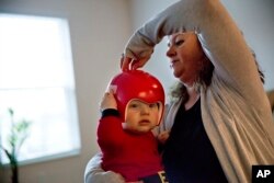 Chesla Whitt, right, takes off a helmet her nine-month old son, Tommy Joe, must wear after being born with a rare condition where his skull bones didn't fuse together properly, at their home in Sandy Hook, Ky., Dec. 14, 2017.