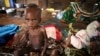 Study in CAR Links Mental Health and Malnutrition 