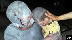 2013年4月25日在敘利亞伊德利卜西北部的的一個城鎮受到空襲後，一名受傷的敘利亞人手抱他受傷的兒子。