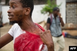 A man shows his injuries on September 20, 2016 near the offices of the main opposition party, Union for Democracy and Social Progress in the Democratic Republic of Congo.