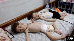 Palestinska djeca Uday, lijevo, i Mohammed Mahra, oboje pate od pothranjenosti, odmaraju se u bolnici Kamal Adwan u Beit Lahiji u sjevernom pojasu Gaze 9. jula 2024.
