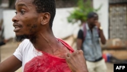 A man shows his injuries on September 20, 2016 near the offices of the main opposition party, Union for Democracy and Social Progress in the Democratic Republic of Congo.