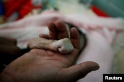 Saleh Hassan al-Faqeh holds the hand of his four-month-old daughter, Hajar, who died at the malnutrition ward of al-Sabeen hospital in Sanaa, Yemen, November 15, 2018.