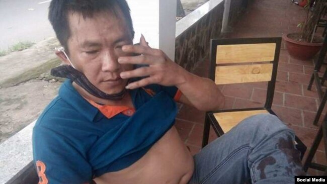 Anh Huỳnh Anh Tuấn sau khi bị đánh ngày 25/6/2017 (Facebook Huu Den)