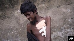 APTOPIX Sri Lanka Health Crisis