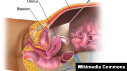 Laparoskopi, metode pembedahan yang tidak memerlukan sayatan-sayatan besar (foto ilustrasi: Wikipedia). 