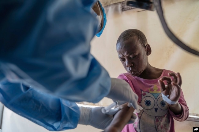 FILE - A health worker attends to a mpox patient, at a treatment center in Munigi, eastern Congo, Aug. 19, 2024. (AP Photo/Moses Sawasawa, file )