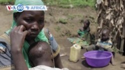 Congo: Icyorezo cya Cholera Gihangayikishije Abatabye Ibyabo Imbere mu Gihugu