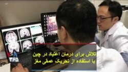 تلاش برای درمان اعتیاد در چین با استفاده از تحریک عمقی مغز