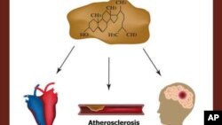 High cholesterol causes - heart attack, stroke, atherosclerosis.