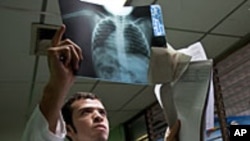 Doctor examines a chest x-ray of a child with pneumonia