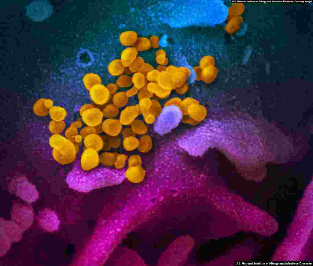 SARS-CoV-2 virions emerge from a human cell after replicating. Despite their apparent longevity, the virions can be destroyed with warm, soapy water. (Courtesy: U.S. National Institute of Allergy and Infectious Diseases)