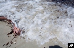 FILE - The arm of a dead migrant is seen at the waterfront of Zuwara, about 105 kilometers (65 miles) west of Tripoli, Libya, Aug. 28, 2015 in this image by photographer and video journalist Mohamed Ben Khalifa, who was killed in Libya on Jan. 19, 2019.