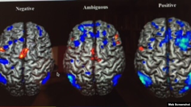 Proyecciones tridimensionales de activaciones y desactivaciones durante pruebas de improvisación para condiciones de diferentes emociones. Foto tomada de sitio web http:www.nature.com/articles/srep18460