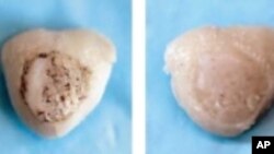 Various stages of cartilage growth on scaffold. The final image on the right shows naturally forming cartilage for comparison.
