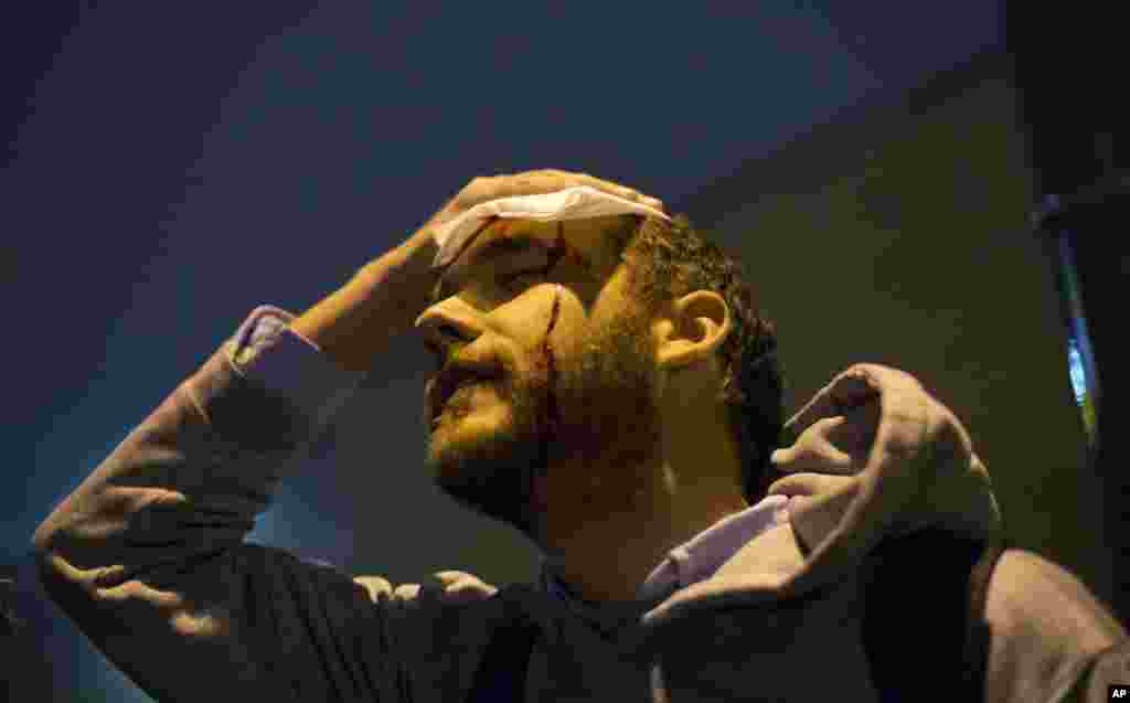 Matt Pearce, a reporter with the Los Angeles Times, holds his head after getting hit by a rock thrown into the crowd during a protest in response to the August shooting of Michael Brown, St. Louis, Missouri, Nov. 23, 2014.