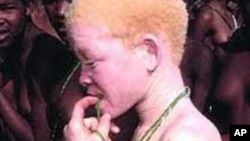 Un enfant albinos du Cameroun