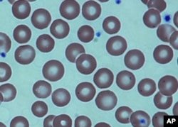 FILE - Red blood cells in a sickle cell patient, after a bone marrow transplant at the National Institutes of Health Clinical Center in Bethesda, Md. Medical Association.