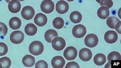 FILE - Red blood cells in a sickle cell patient, after a bone marrow transplant at the National Institutes of Health Clinical Center in Bethesda, Md. Medical Association. 