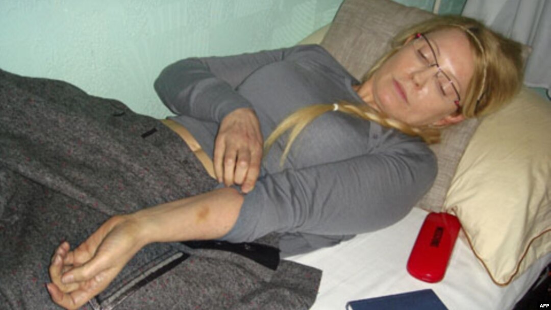 Sobiq Bosh vazira Yuliya Timoshenko bir yildan beri qamoqda
