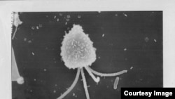 A tiny eukaryotic alga (the scale bar below is about 1 micron) related to those in the Monterrey Bay Aquarium Research Institute study. (Photo by Kurt Buck, MBARI)