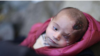 Solidarité avec un bébé devenu borgne après un raid en Syrie