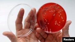 Blue and green clay might be able to kill MRSA (Methicillin-resistant Staphylococcus aureus). MRSA is an antibiotic resistant bacteria, sometimes called a superbug. (REUTERS)
