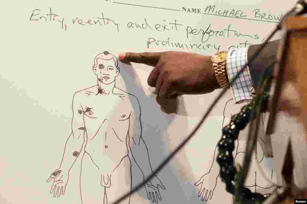 Pengacara keluarga Brown Daryl Parks menunjukkan diagram otopsi cedera di kepala yang merupakan tembakan fatal yang menewaskan Michael Brown, dalam sebuah konferensi pers, Ferguson, Missouri, 18 Agustus 2014.