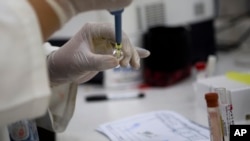 FILE - Blood samples from pregnant women are analyzed for the presence of the Zika virus at a maternity hospital in Guatemala City, Feb. 2, 2016. 