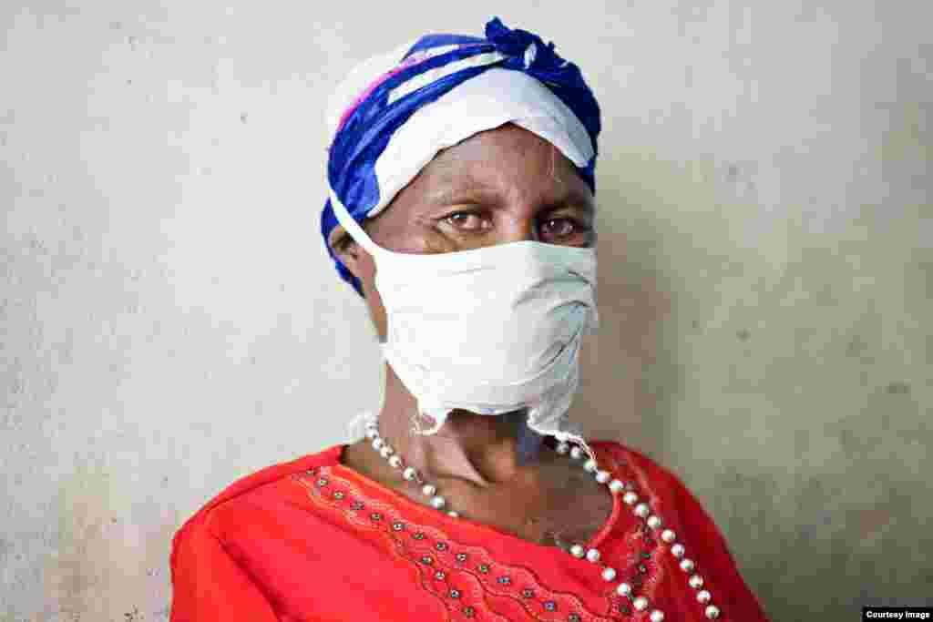 The woman with the surgical mask, hiding her terrible injuries (Photo: E. O’Brien Photography)