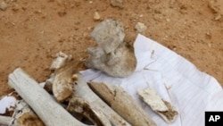 Bone fragments at the site which is thought to be a possible mass grave near to Abu Salim prison in Tripoli, Libya, Sunday, Sept. 25, 2011.