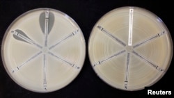 FILE - Two plates which were coated with an antibiotic-resistant bacteria called Klebsiella with a mutation called NDM 1 and then exposed to various antibiotics are seen at the Health Protection Agency in north London, March 9, 2011. 