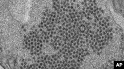 FILE - This 2014 image made available by the Centers for Disease Control and Prevention shows numerous, spheroid-shaped Enterovirus-D68 (EV-D68) virions. Doctors have suspected acute flaccid myelitis might be tied to the virus. 