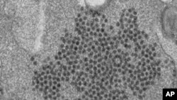 FILE - This 2014 file electron microscope image made available by the Centers for Disease Control and Prevention shows numerous, spheroid-shaped Enterovirus-D68 (EV-D68) virions. Doctors have suspected a mysterious paralyzing illness, acute flaccid myelit