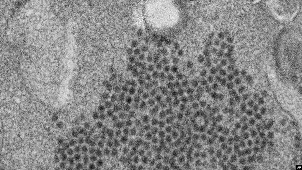 ARCHIVO - Esta imagen provista por los Centros de EE.UU. para el Control y PrevenciÃ³n de Enfermedades muestra numerosos viriones Enterovirus-D68 (EV-D68). (Cynthia S. Goldsmith, Yiting Zhang/CDC via AP).
