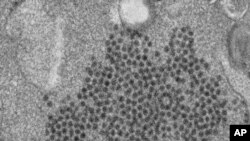 ARCHIVO - Esta imagen provista por los Centros de EE.UU. para el Control y Prevención de Enfermedades muestra numerosos viriones Enterovirus-D68 (EV-D68). (Cynthia S. Goldsmith, Yiting Zhang/CDC via AP).