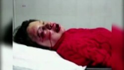 Մամուլի ազատությունն անկում է ապրում աշխարհում