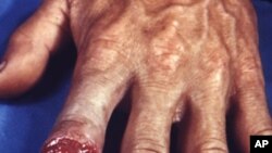 گوئٹے مالا کے لوگوں پر کیے گئے جنسی طبی تجربات پر امریکہ کی معافی