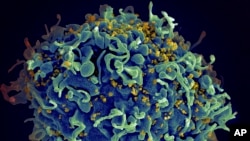 FILE - This electron microscope image made available by the U.S. National Institutes of Health shows a human T cell, in blue, under attack by HIV, in yellow, the virus that causes AIDS.