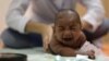 Study Shows Extent of Brain Damage From Zika Infections