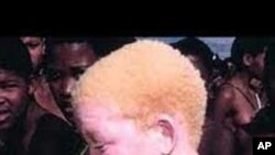 Un enfant albinos du Cameroun