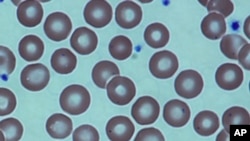 FILE - Red blood cells in a sickle-cell patient following a bone marrow transplant at the National Institutes of Health Clinical Center, Bethesda, Md.